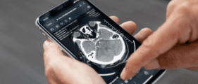 doctor holding mobile with StrokeViewer results on