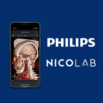 StrokeViewer and partnership Philips-Nicolab
