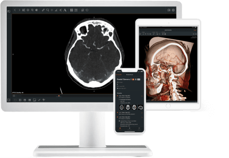 Multi device StrokeViewer screens