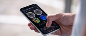 Nicolab Attains Significant Milestone in Stroke Care Advancement with U.S. FDA Clearance for CT Perfusion Algorithm in StrokeViewer