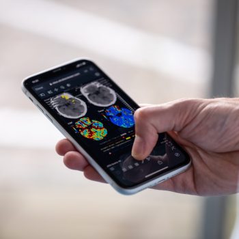 Nicolab Attains Significant Milestone in Stroke Care Advancement with U.S. FDA Clearance for CT Perfusion Algorithm in StrokeViewer