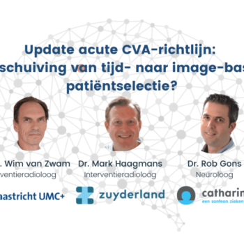 Webinar 28 June: update van de acute CVA-richtlijn (Dutch)