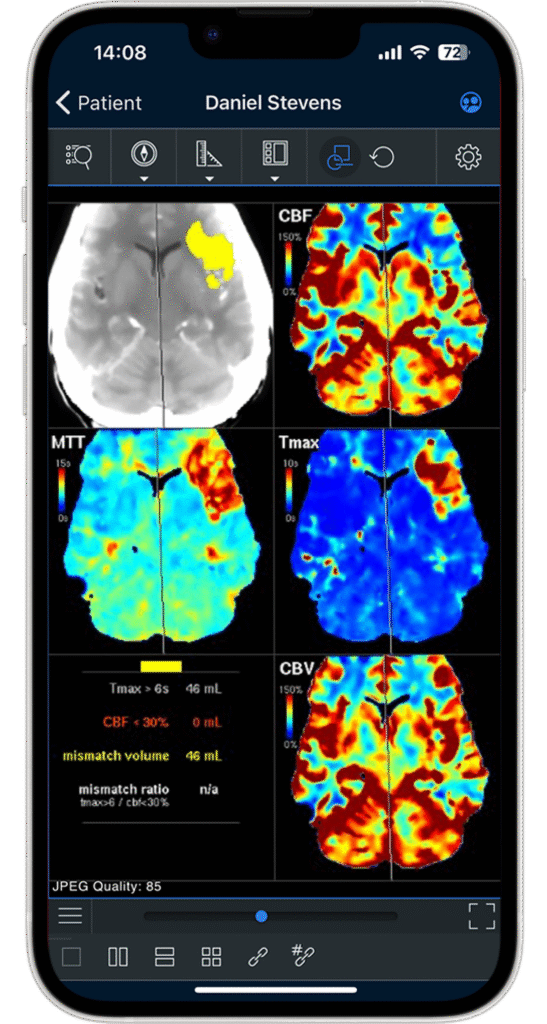 Mobile dicom viewer for diagnostic use