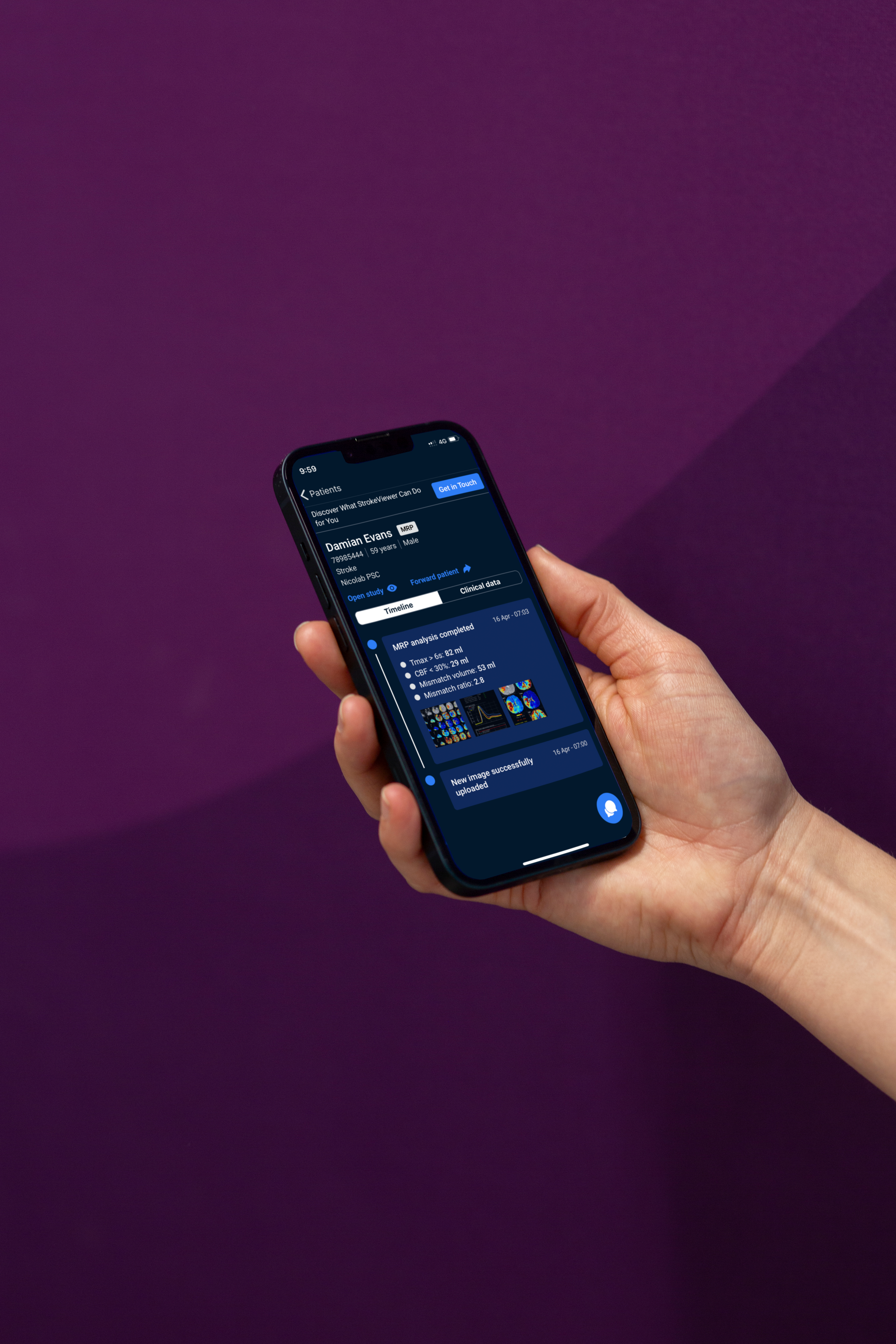 Hand holding Phone showing patient timeline with MR Perfusion analysis