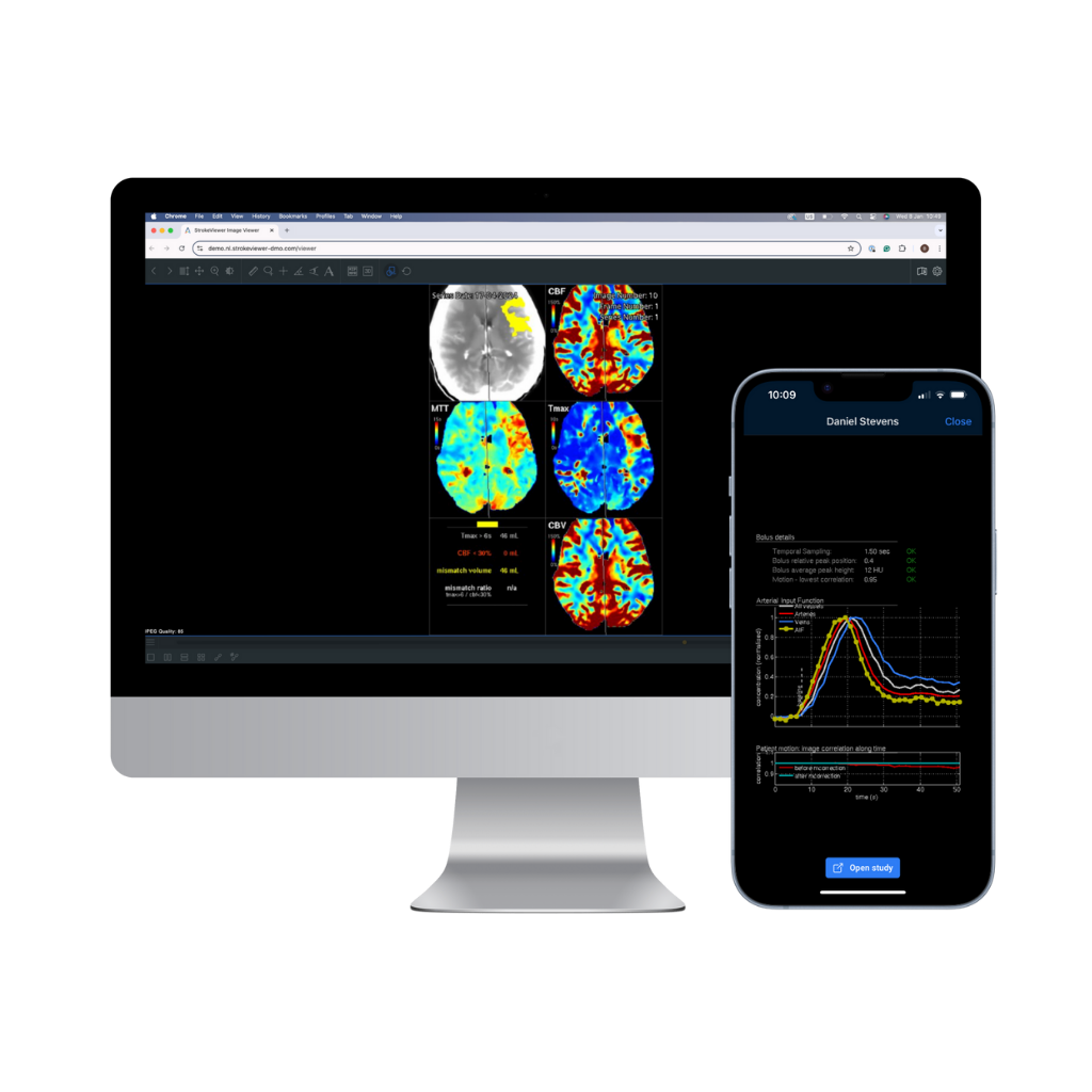 showing automated perfusion analysis on computer screen and phone